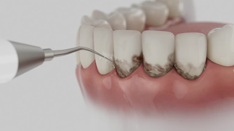Trusted Root Canal Treatment service in Burlington, WI - Dentist Open Now